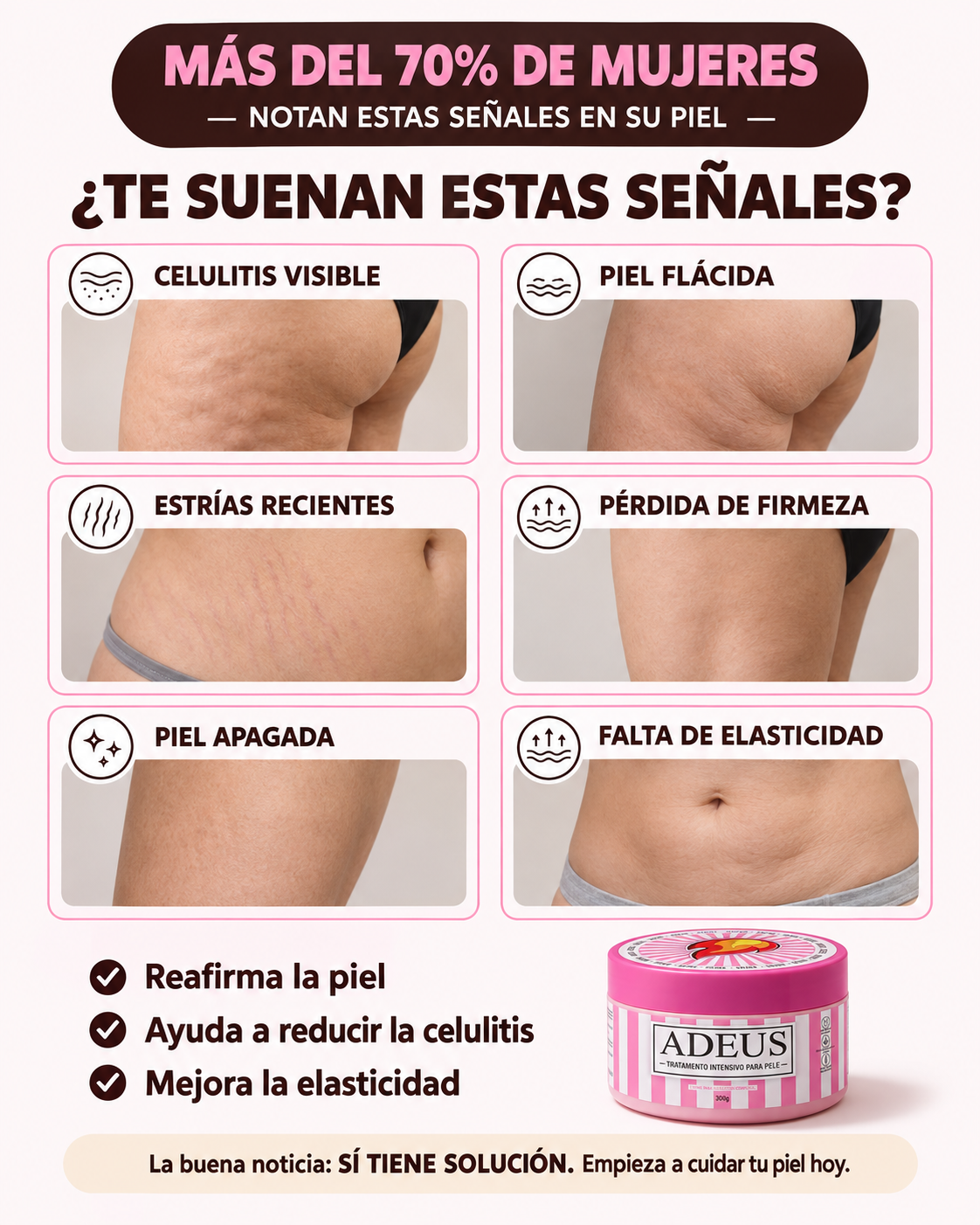 ADEUS® Crema Corporal Intensiva — Piel Más Suave, Lisa y Cuidada