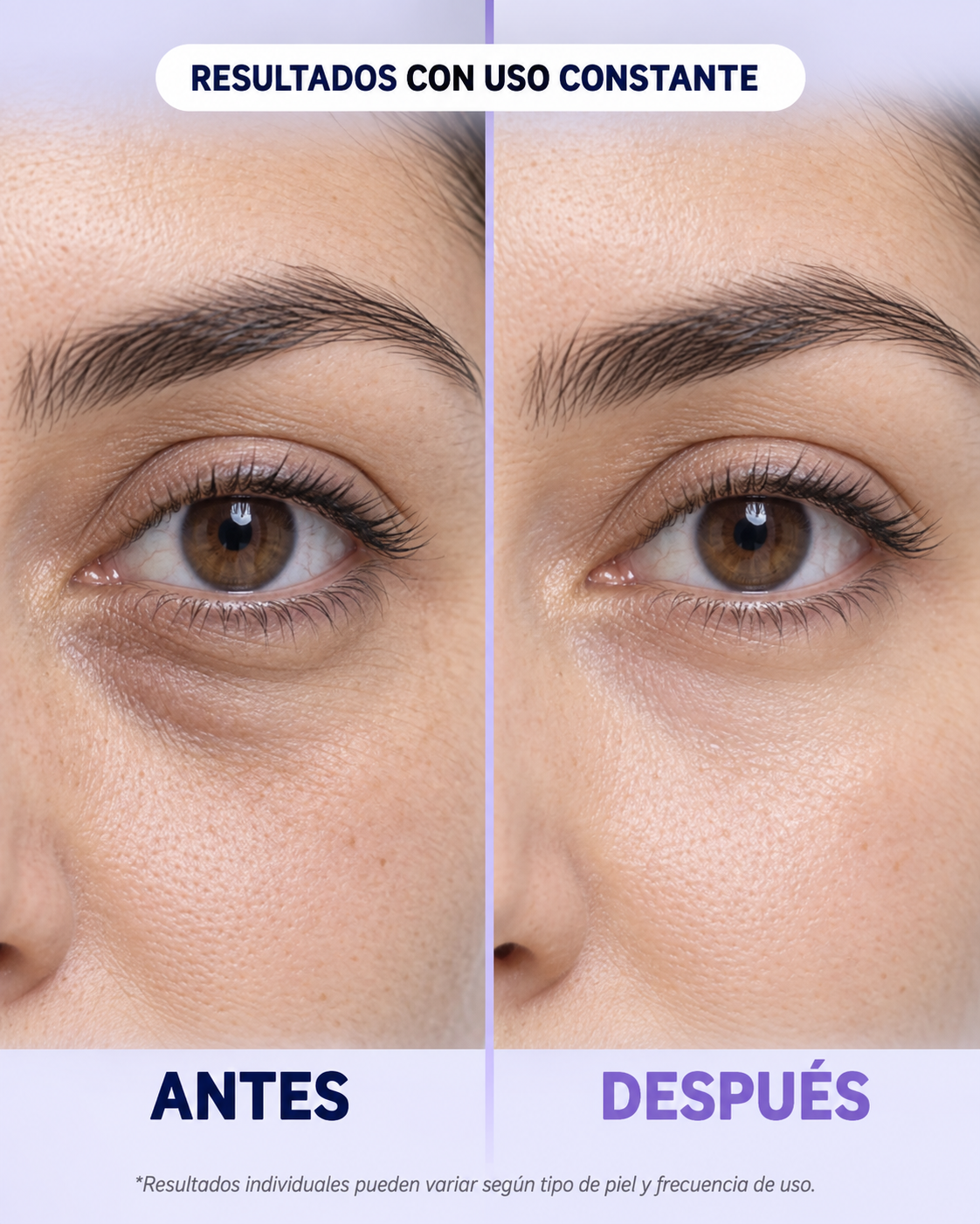 Lumière Eye Elixir™ – Sérum Rejuvenecedor 5 en 1