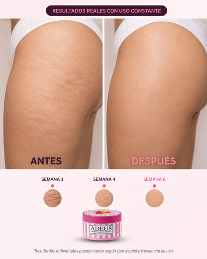 ADEUS® Crema Corporal Intensiva — Piel Más Suave, Lisa y Cuidada